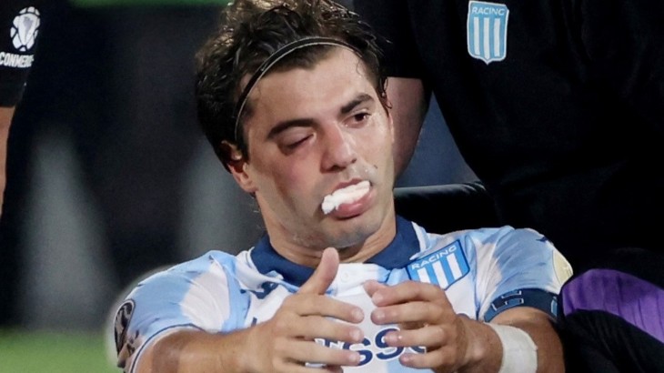 Mala para Racing: Santiago Sosa tiene que ser operado de la fractura